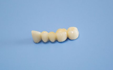 Белые коронки на зубы в Китае