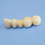 Белые коронки на зубы – поликлиника Цюань Юй г. Хэйхэ