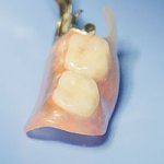 Съемные зубные протезы для детей – поликлиника Цюань Юй г. Хэйхэ