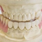 Микропротезирование зубов – поликлиника Цюань Юй г. Хэйхэ