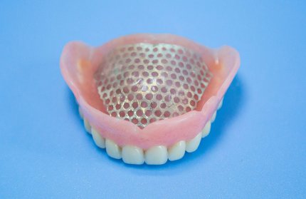 Нейлоновые зубные протезы в Китае - их особенности, преимущества и недостатки