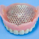 Нейлоновые зубные протезы – поликлиника Цюань Юй г. Хэйхэ